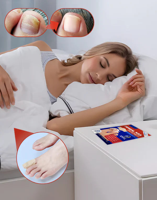 ClearNail™ seenevastased plaastrid küüntele