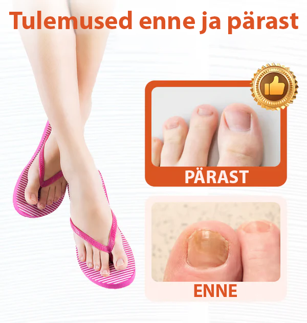 ClearNail™ seenevastased plaastrid küüntele